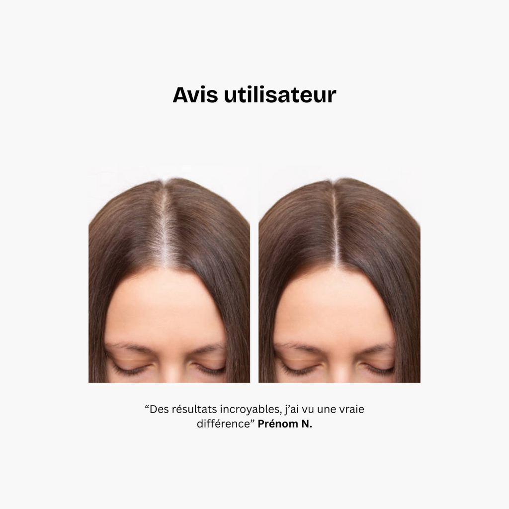 Complément alimentaire