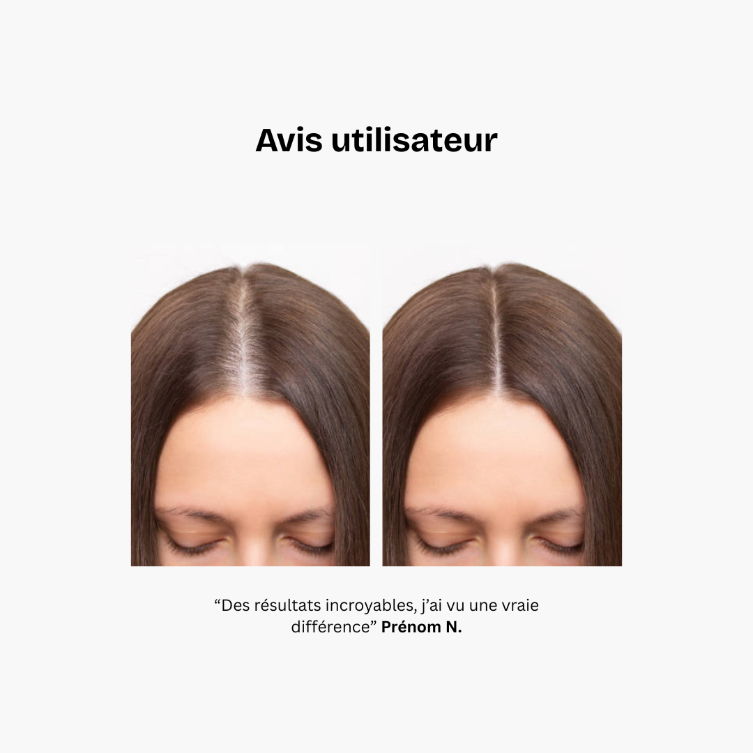 Complément alimentaire